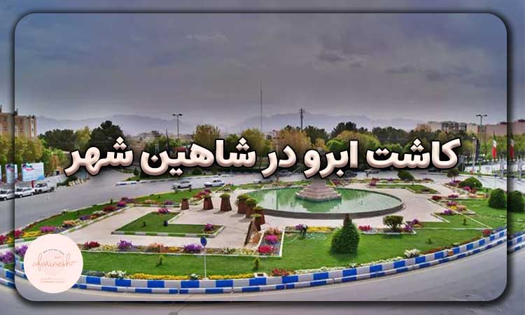 کاشت ابرو در شاهین شهر