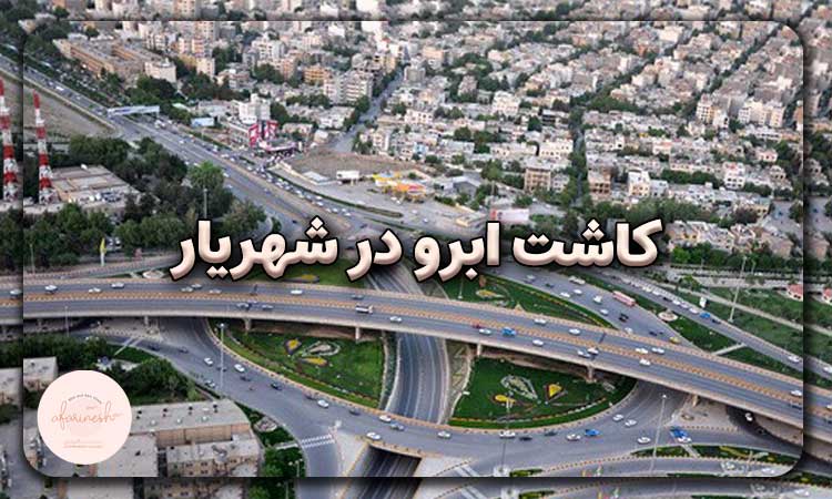 کاشت ابرو در شهریار