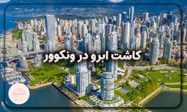 کاشت ابرو در ونکوور