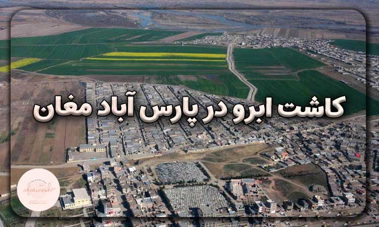 کاشت ابرو در پارس آباد مغان