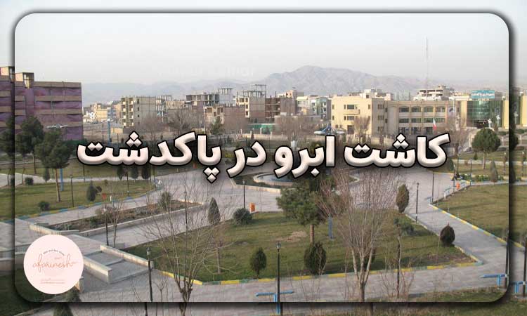 کاشت ابرو در پاسداران