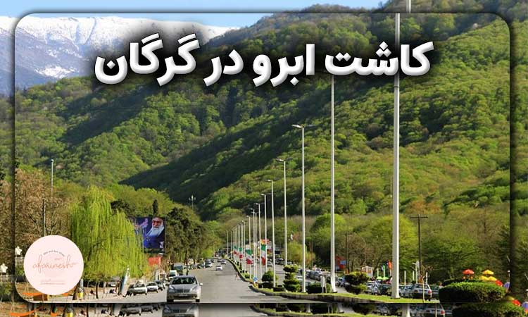 کاشت ابرو در گرگان