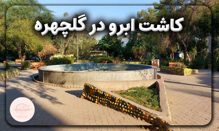کاشت ابرو در گلچهره