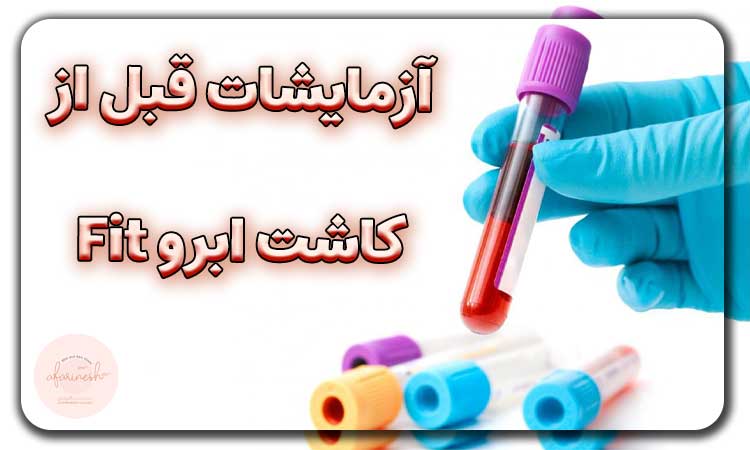 آزمایشات قبل از کاشت ابرو Fit
