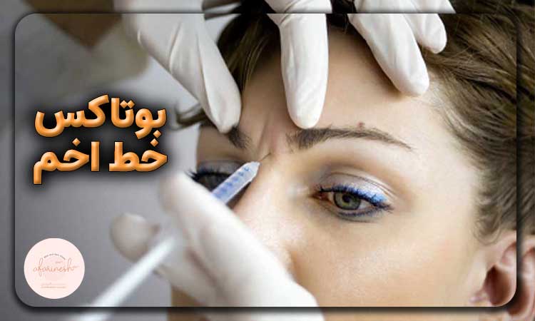 مراقبت بعد از بوتاکس خط اخم و خنده