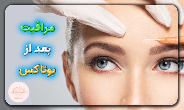 مراقبت بعد از بوتاکس