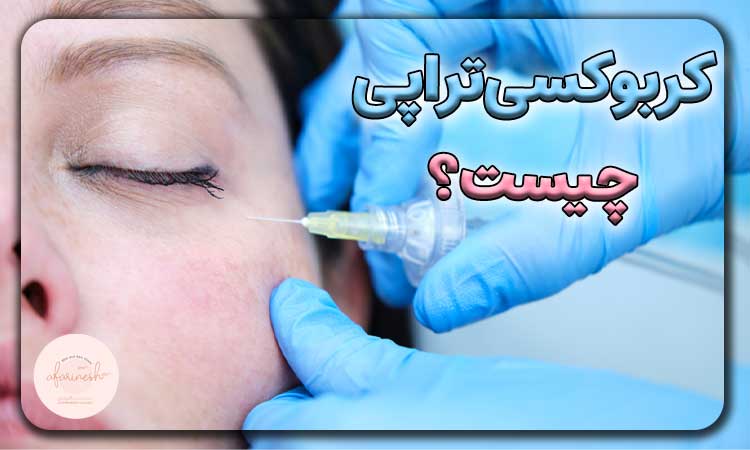 کربوکسی تراپی چیست؟