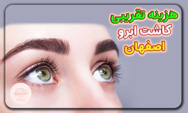 هزینه تقریبی کاشت ابرو در اصفهان