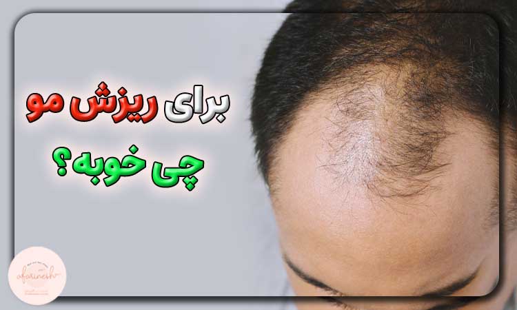 برای ریزش مو چی خوبه