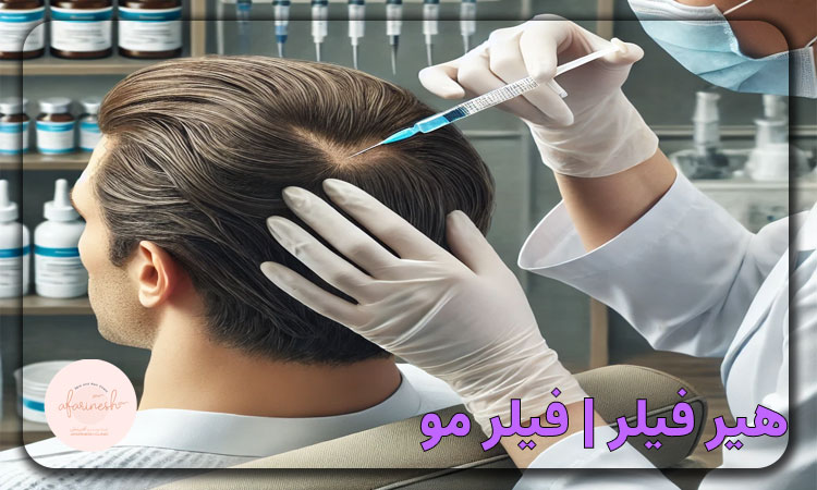 هیر فیلر