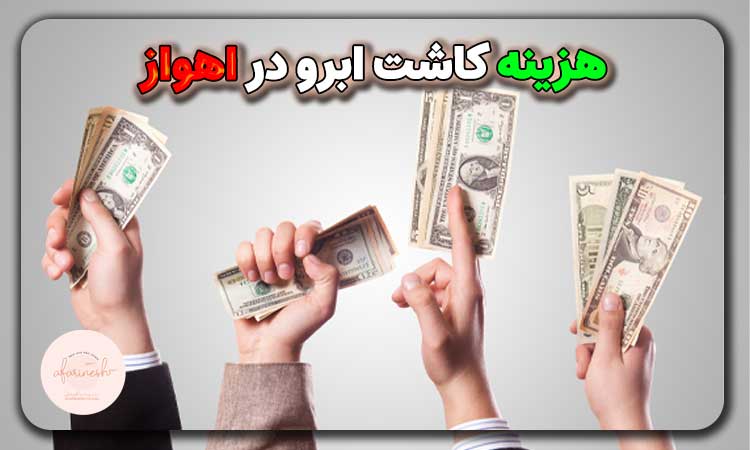 هزینه کاشت ابرو در اهواز