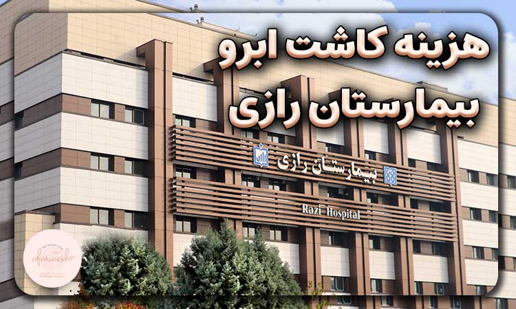 هزینه کاشت ابرو در بیمارستان رازی