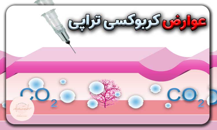 عوارض کربوکسی تراپی