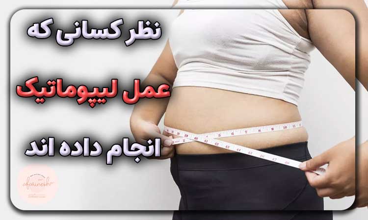 نظر کسانی که عمل لیپوماتیک انجام داده اند