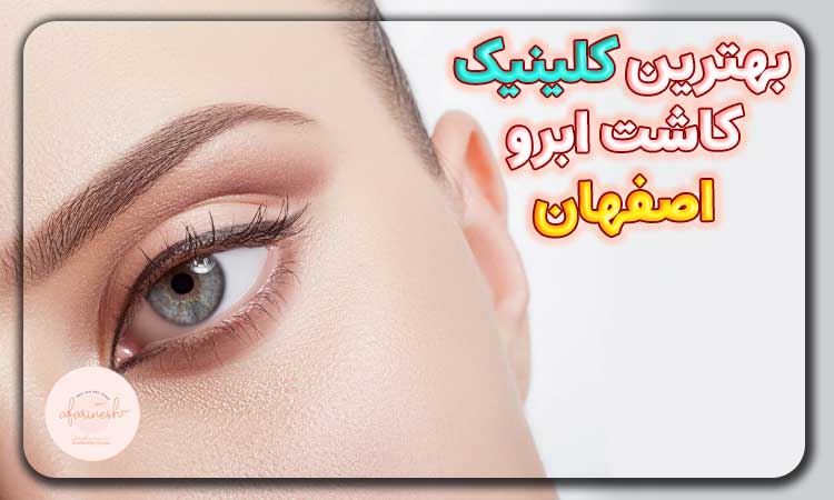 بهترین کلینیک های کاشت ابرو در اصفهان از نظر هزینه