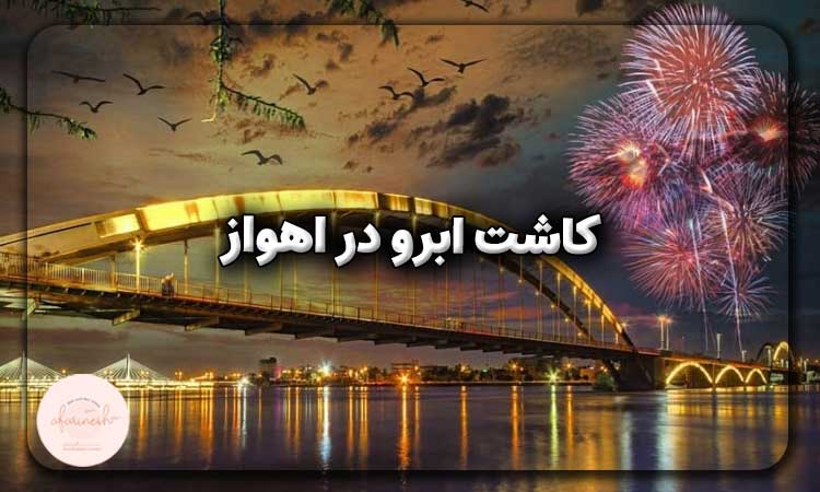 کاشت ابرو در اهواز