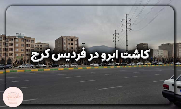 کاشت ابرو در فردیس کرج