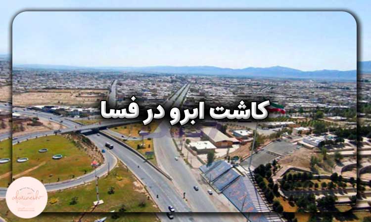 کاشت ابرو در فسا