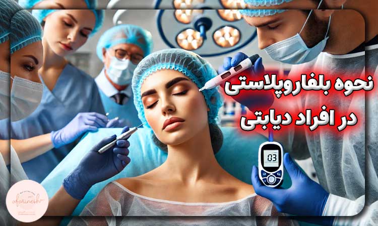 نحوه انجام بلفاروپلاستی در افراد دیابتی