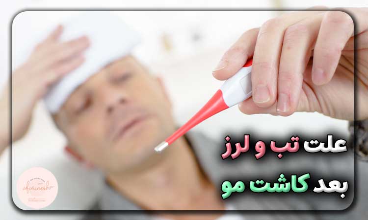علت تب و لرز بعد از کاشت مو