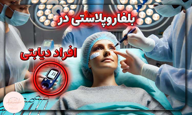 بلفاروپلاستی در افراد دیابتی