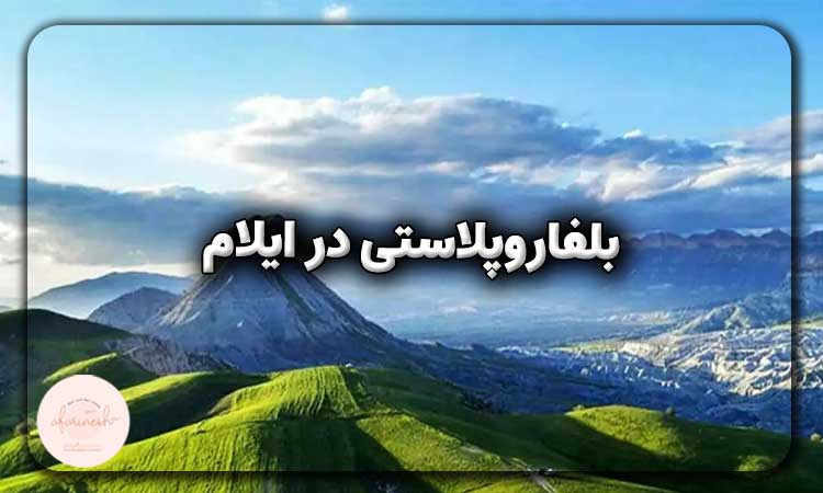 بلفاروپلاستی در ایلام