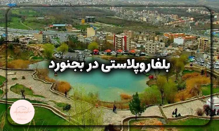 بلفاروپلاستی در بجنورد
