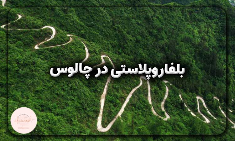 بلفاروپلاستی در چالوس