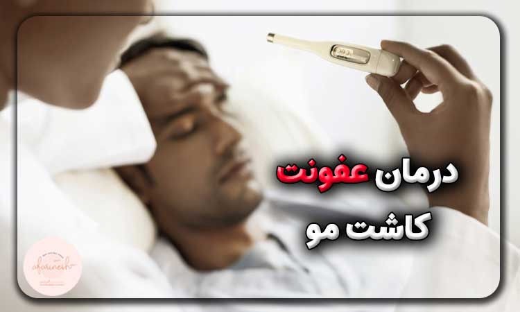 درمان عفونت کاشت مو