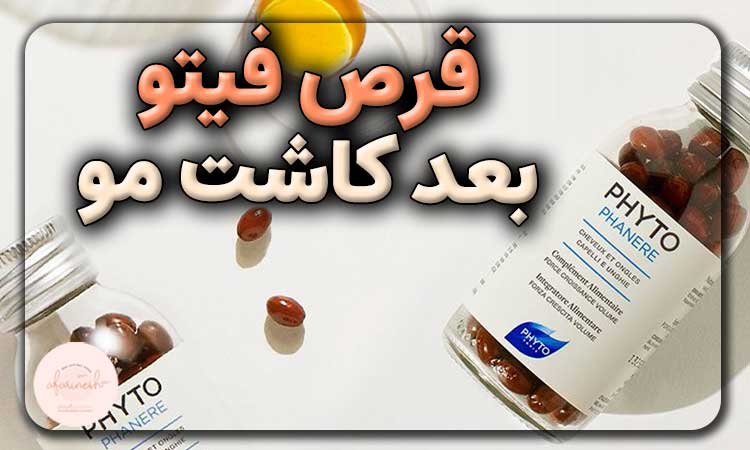 قرص فیتو بعد از کاشت مو