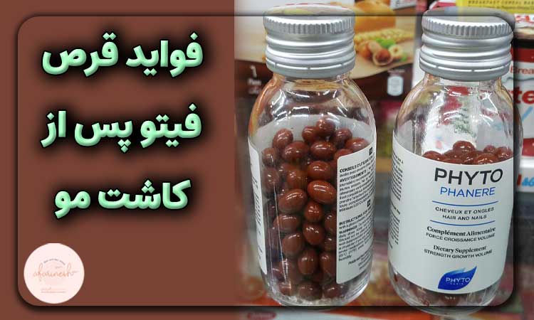 فواید قرص فیتو پس از کاشت مو