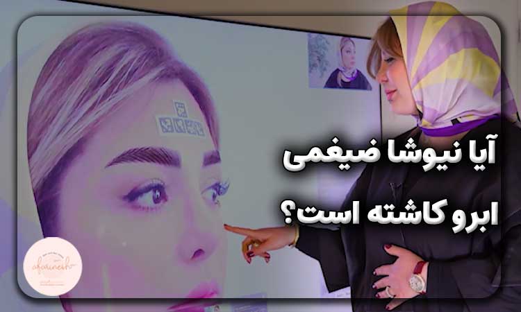 آیا نیوشا ضیغمی کاشت ابرو انجام داده است؟