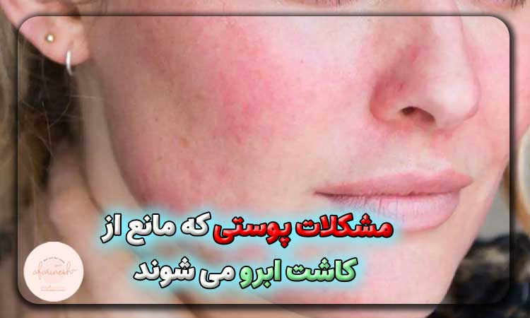 مشکلات پوستی