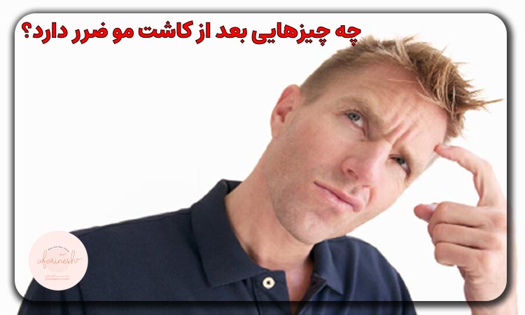 چه چیزهایی بعد از کاشت مو ضرر دارد