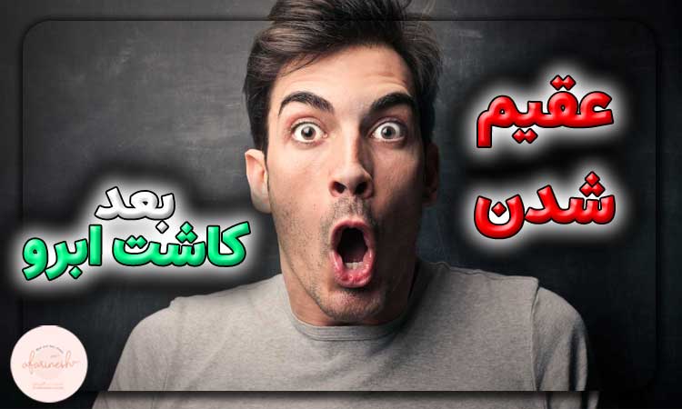 تاثیر کاشت ابرو بر عقیم شدن