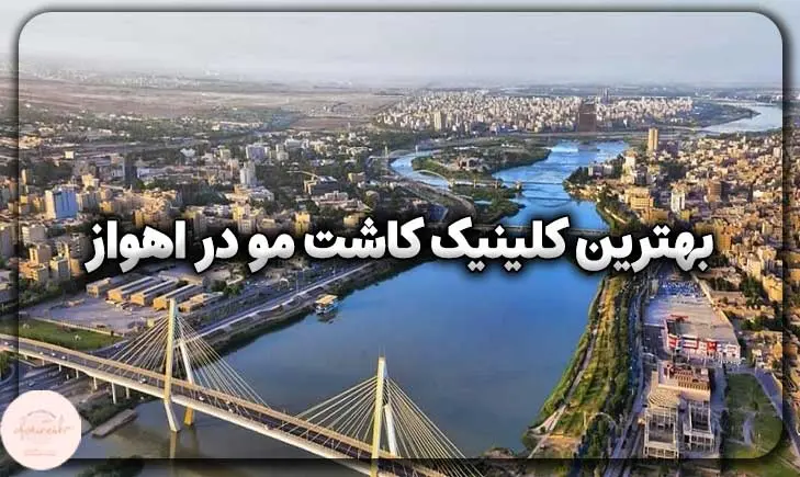 بهترین کلینیک کاشت مو در اهواز