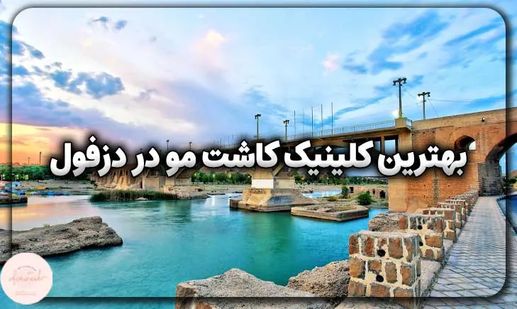بهترین کلینیک کاشت مو در دزفول