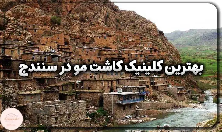 بهترین کلینیک کاشت مو در سنندج