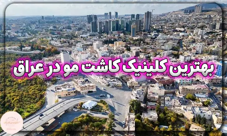 بهترین کلینیک کاشت مو در عراق