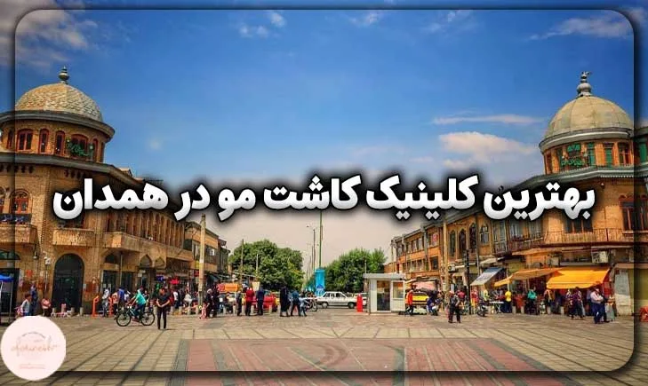 بهترین کلینیک کاشت مو در همدان