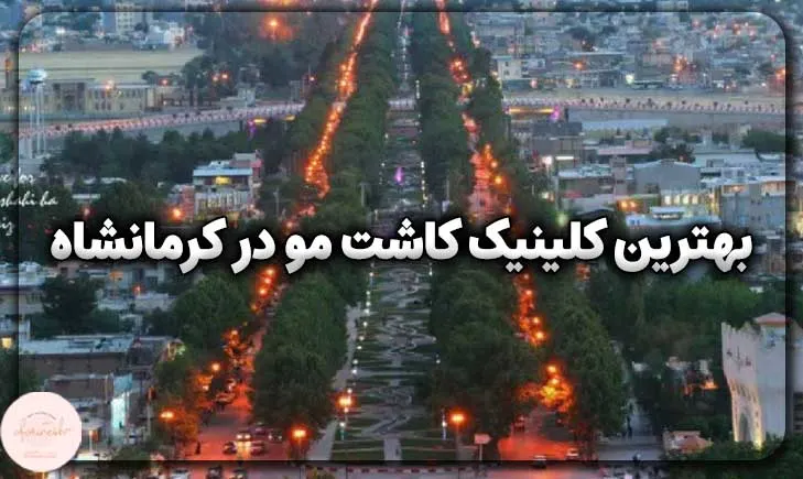 بهترین کلینیک کاشت مو در کرمانشاه