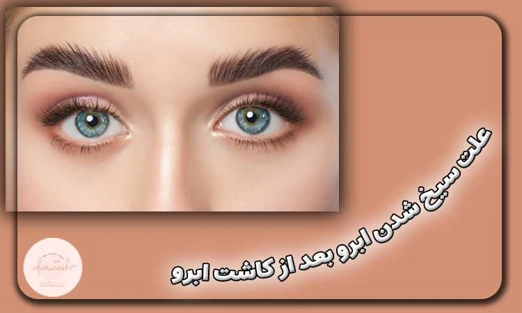 علت سیخ شدن ابرو بعد از کاشت ابرو