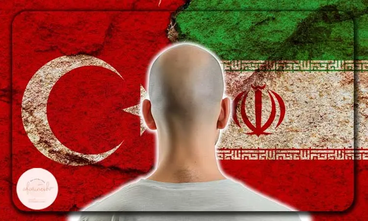 کاشت مو در ترکیه بهتر است یا ایران