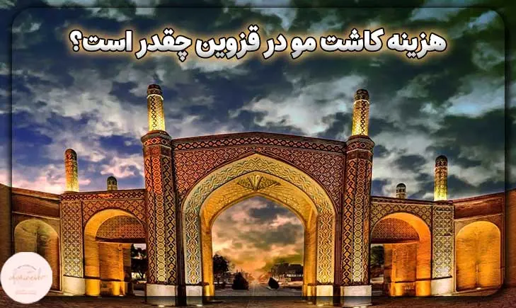 هزینه کاشت مو در قزوین چقدر است؟