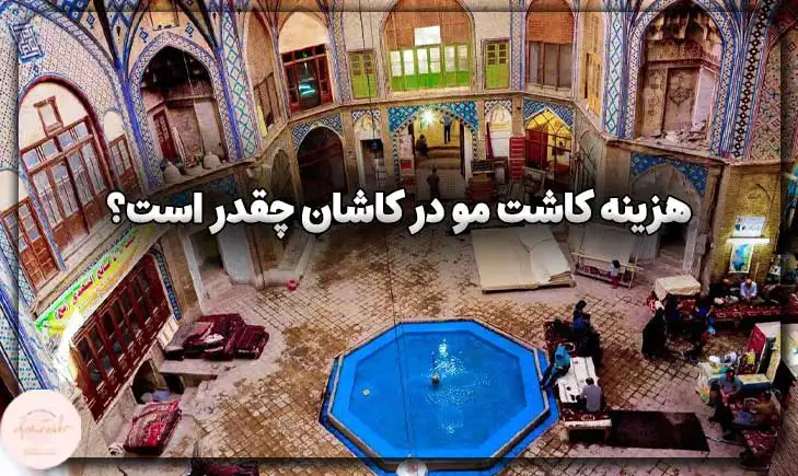 هزینه کاشت مو در کاشان چقدر است؟