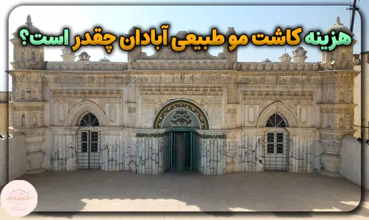 هزینه کاشت مو طبیعی آبادان چقدر است؟
