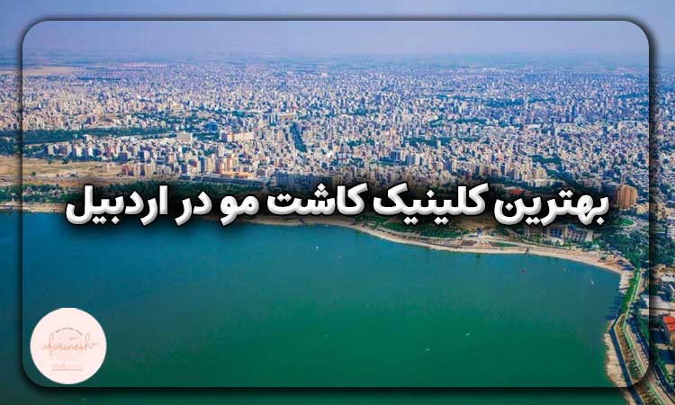 بهترین کلینیک کاشت مو در اردبیل