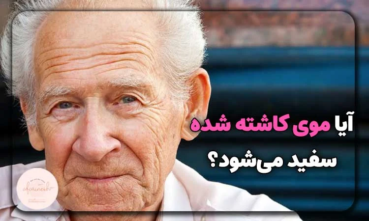 ایا موی کاشته شده سفید میشود