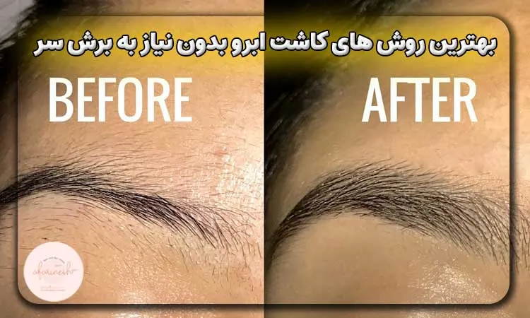 بهترین روش های کاشت ابرو بدون نیاز به برش سر