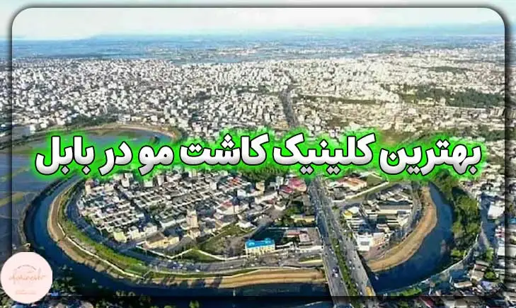 بهترین کلینیک کاشت مو در بابل